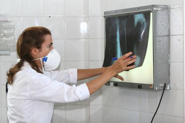 Por causa da tuberculose, 4,5 mil pessoas morrem todos os dias no mundo 