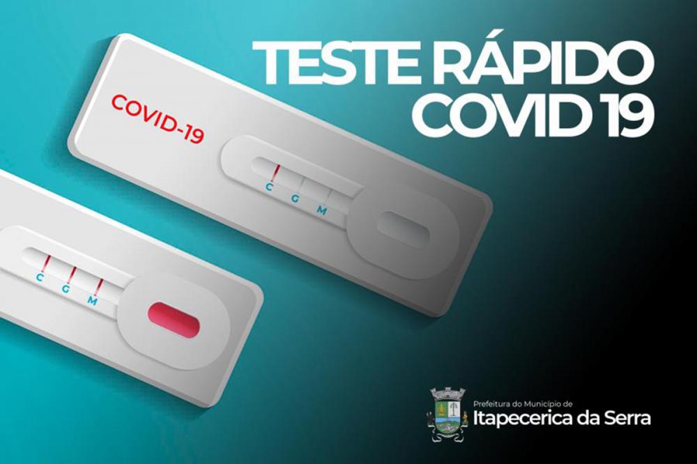 Itapecerica da Serra: Teste para Covid-19 agora pode ser realizado no CEM