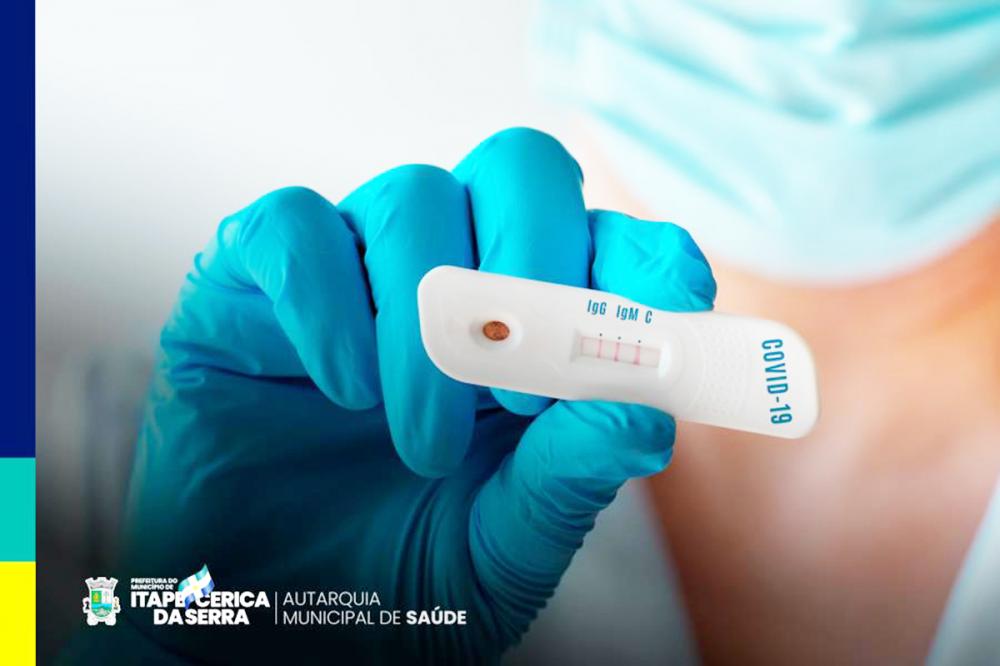 Testes rápidos para Covid-19 voltam a ser realizados no CEM de Itapecerica da Serra